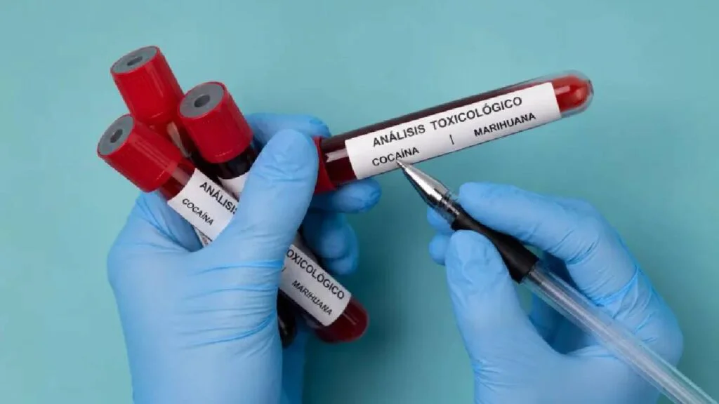 TEST TOXICOLOGICOS